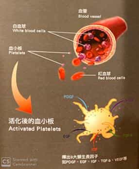 PRP治療原理示意圖